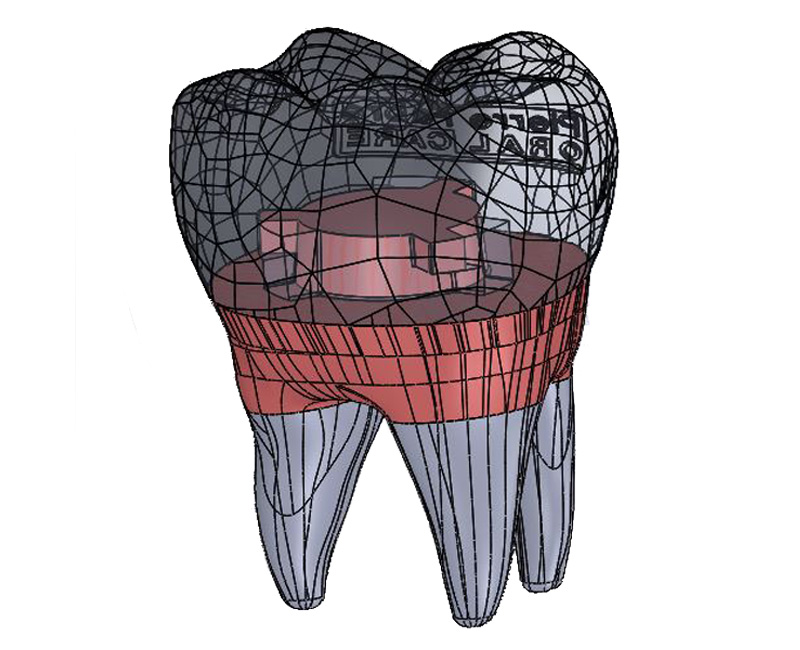 3D design drawing of tooth, dental care,
